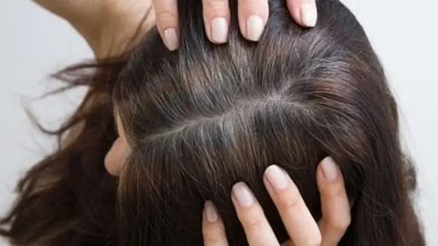 क्या आप भी हैं सफेद बालों से परेशान? इन बातों का रखें खास ख्याल