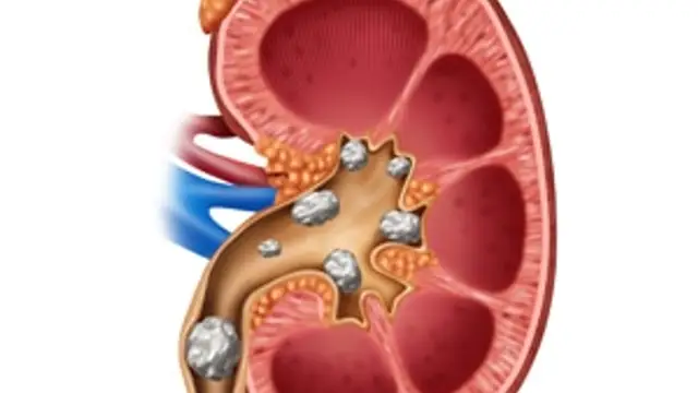 Health Tips: कहीं आपकी किडनी भी तो नहीं हो रही है खराब? जानिए ये संकेत